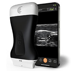 diagnostic ultrasound