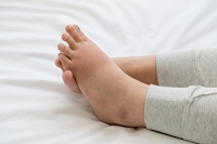 Foot and Leg Problems During Pregnancy