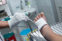 Early Detection of Abrasions on the Feet is Important for Diabetics
