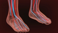 How Can I Improve Circulation in My Feet and Legs?