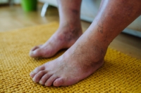 Daily Habits for Diabetic Foot Care
